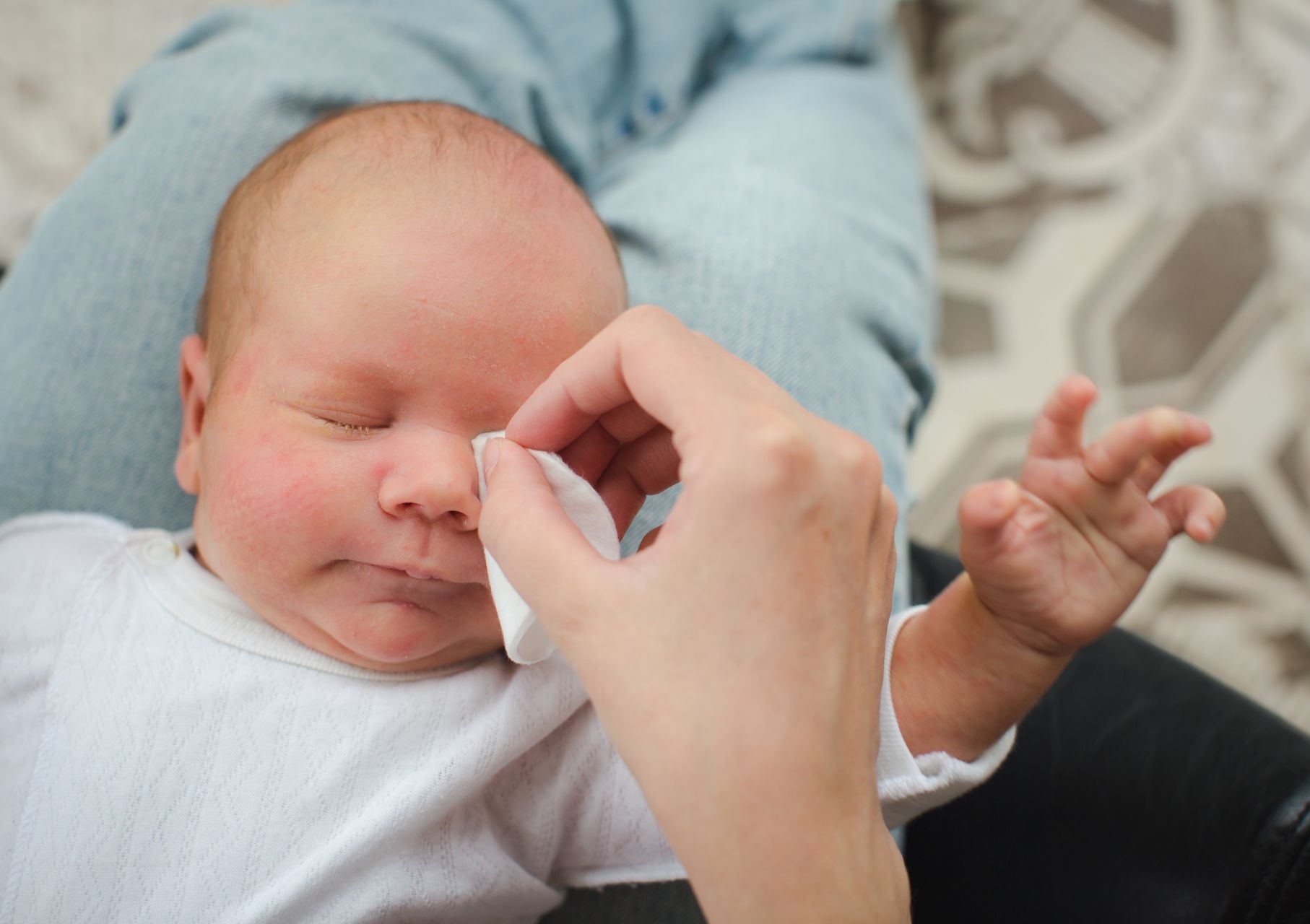 Oftalmologia Pediátrica: devo limpar os olhos do bebê?